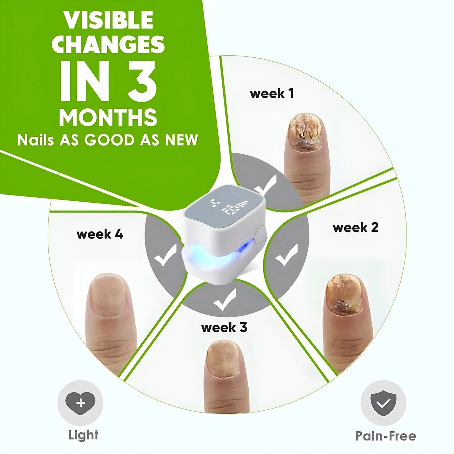 Nail Fungus Laser Assist Tool UV Professional Kynsien sienen puhdistus Laserlaite Kynsien valohoitolamppu Type-C Lataus Tukkukauppa