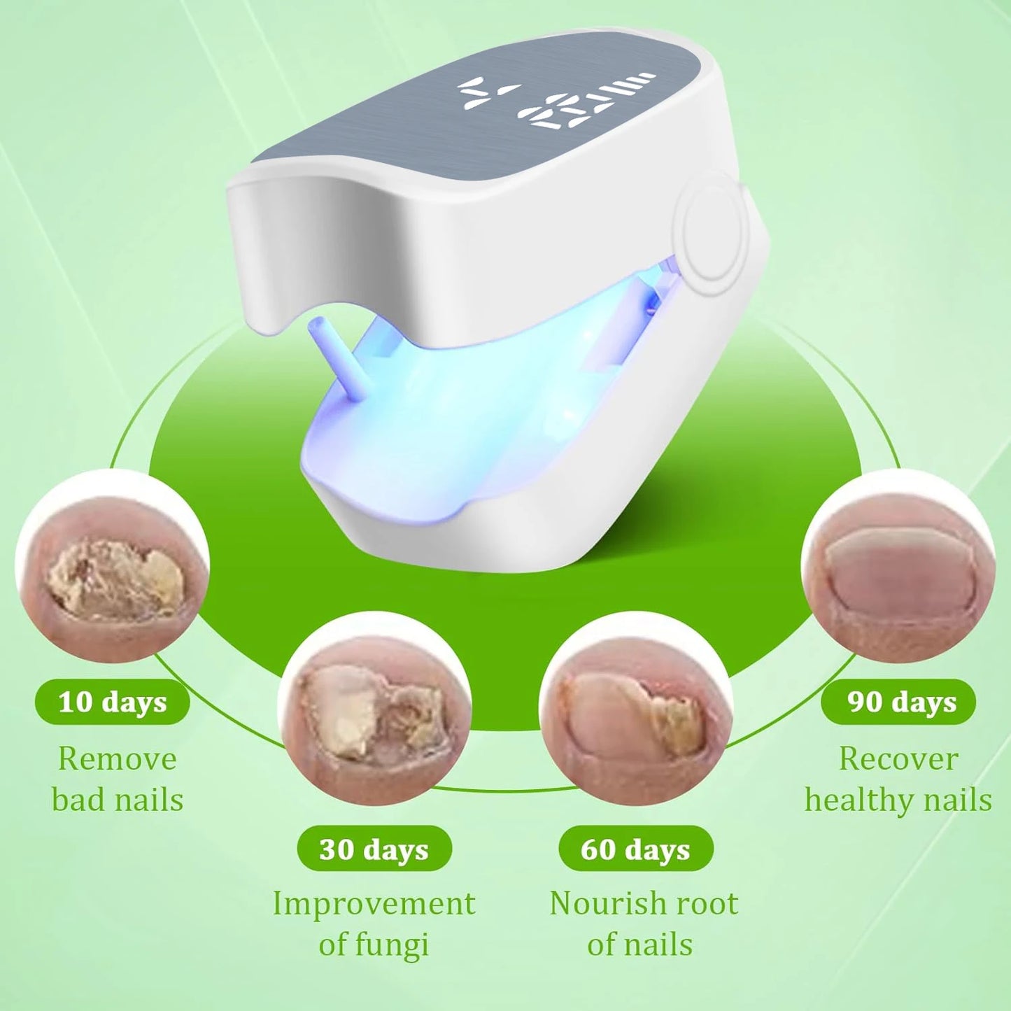 Nail Fungus Laser Assist Tool UV Professional Kynsien sienen puhdistus Laserlaite Kynsien valohoitolamppu Type-C Lataus Tukkukauppa