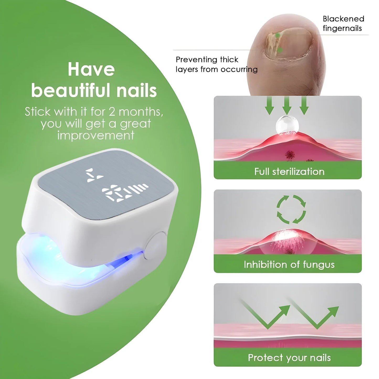 Nail Fungus Laser Assist Tool UV Professional Kynsien sienen puhdistus Laserlaite Kynsien valohoitolamppu Type-C Lataus Tukkukauppa